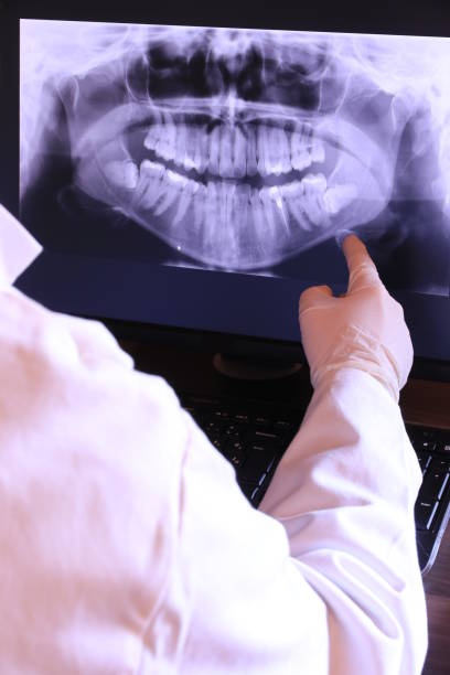 Best Emergency Tooth Extraction in Balch Springs, TX